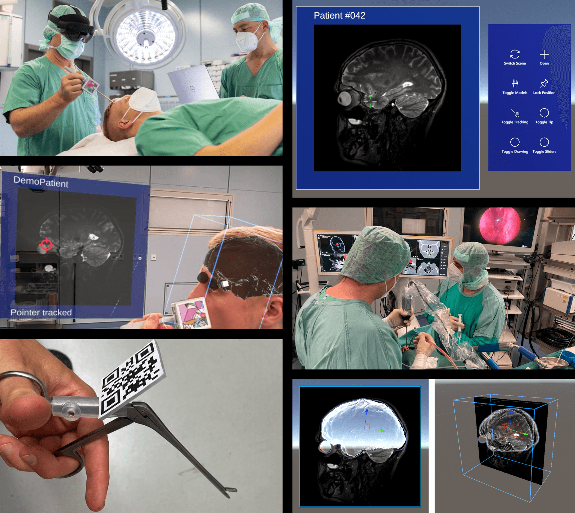 AR in Surgery - Hololens 2