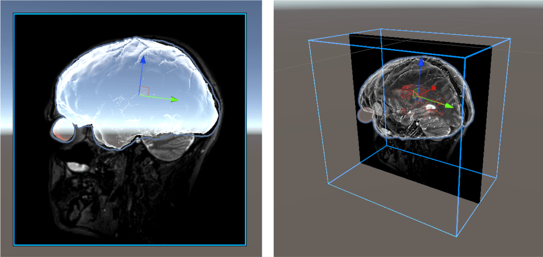 Positioning of DICOM data in Unity